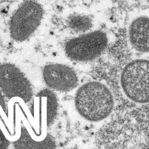 EUA confirmam primeiro caso de "varíola dos macacos" | AGORA CNN